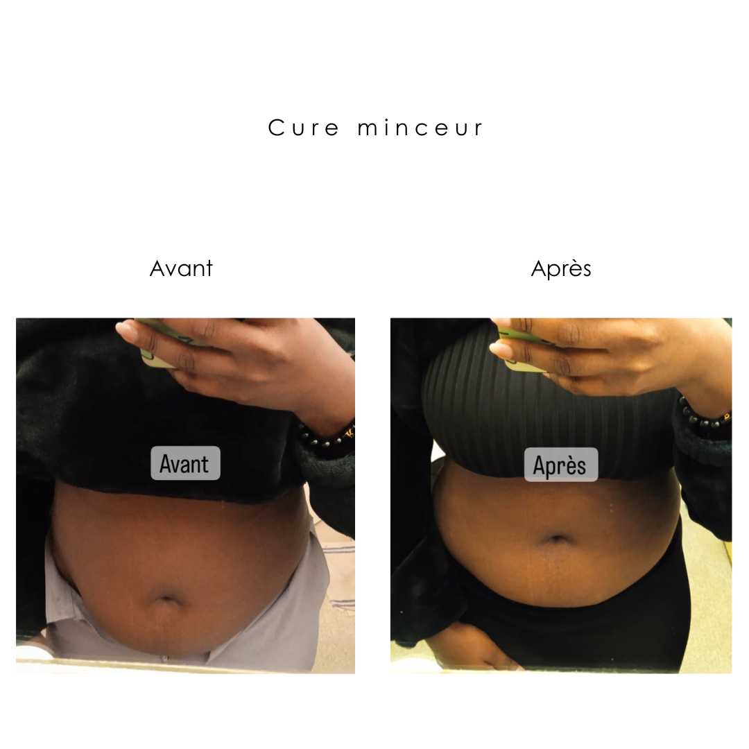 Cure minceur
