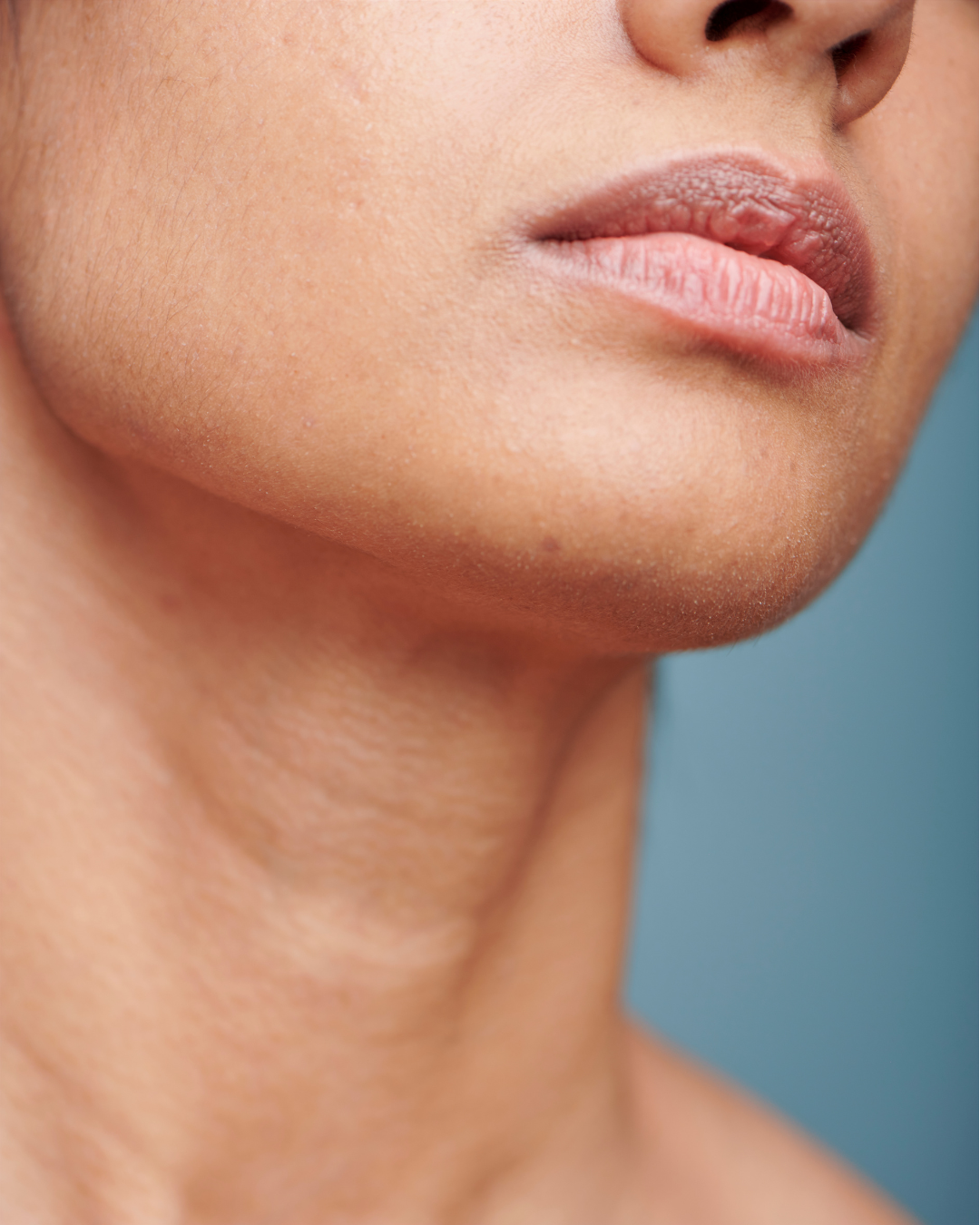 visage gonflé femme 