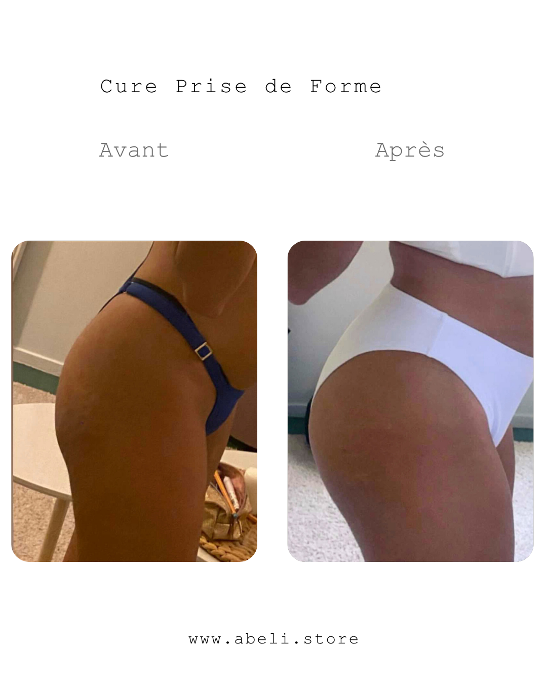 Pack prise de forme