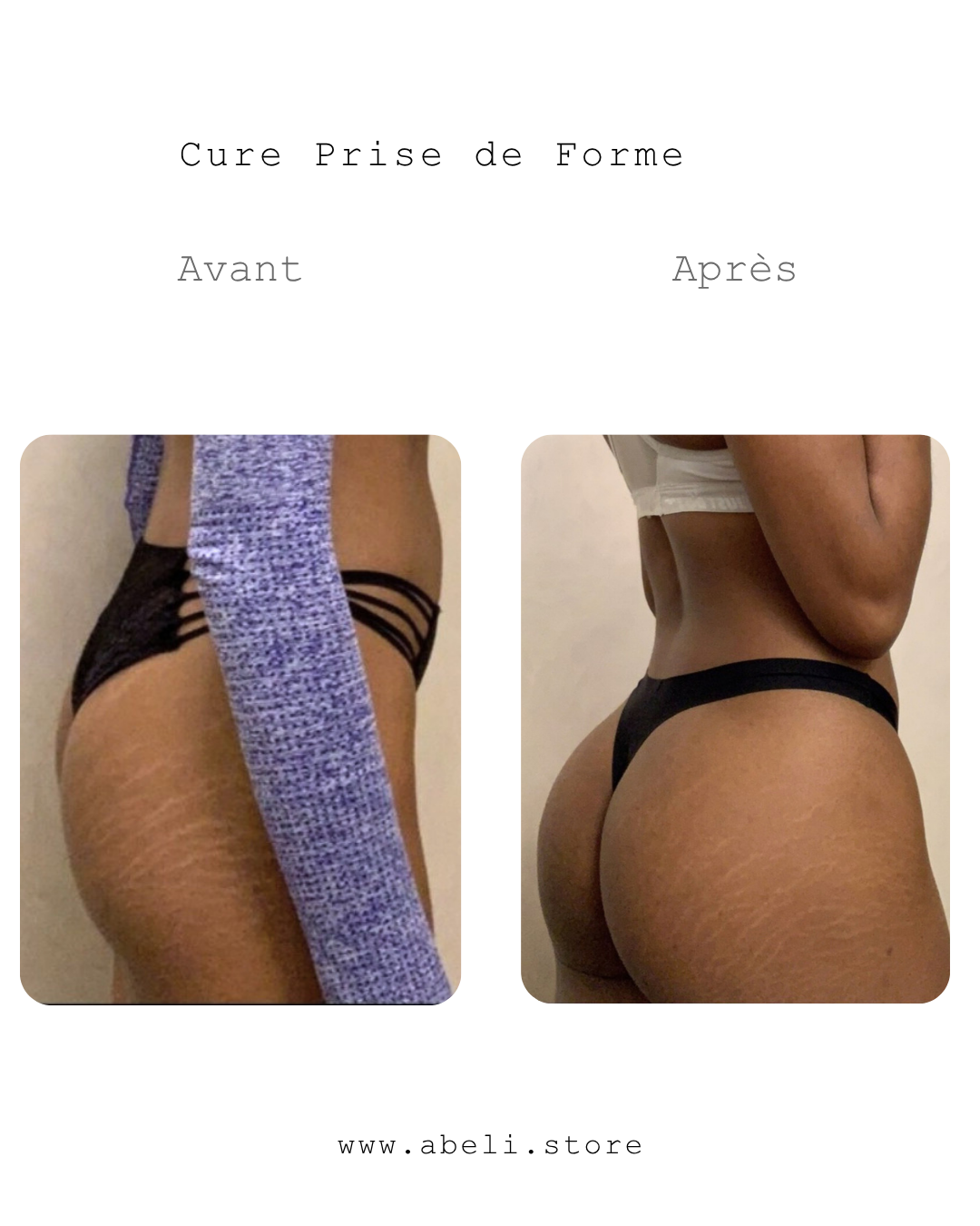 Pack prise de forme