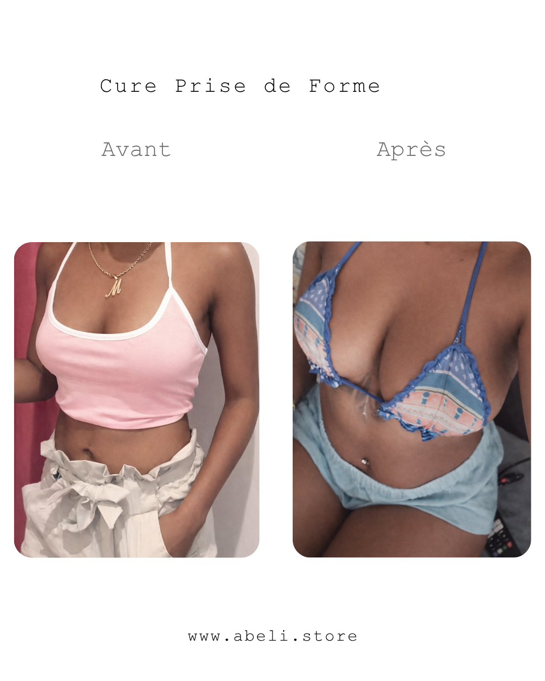 Pack prise de forme