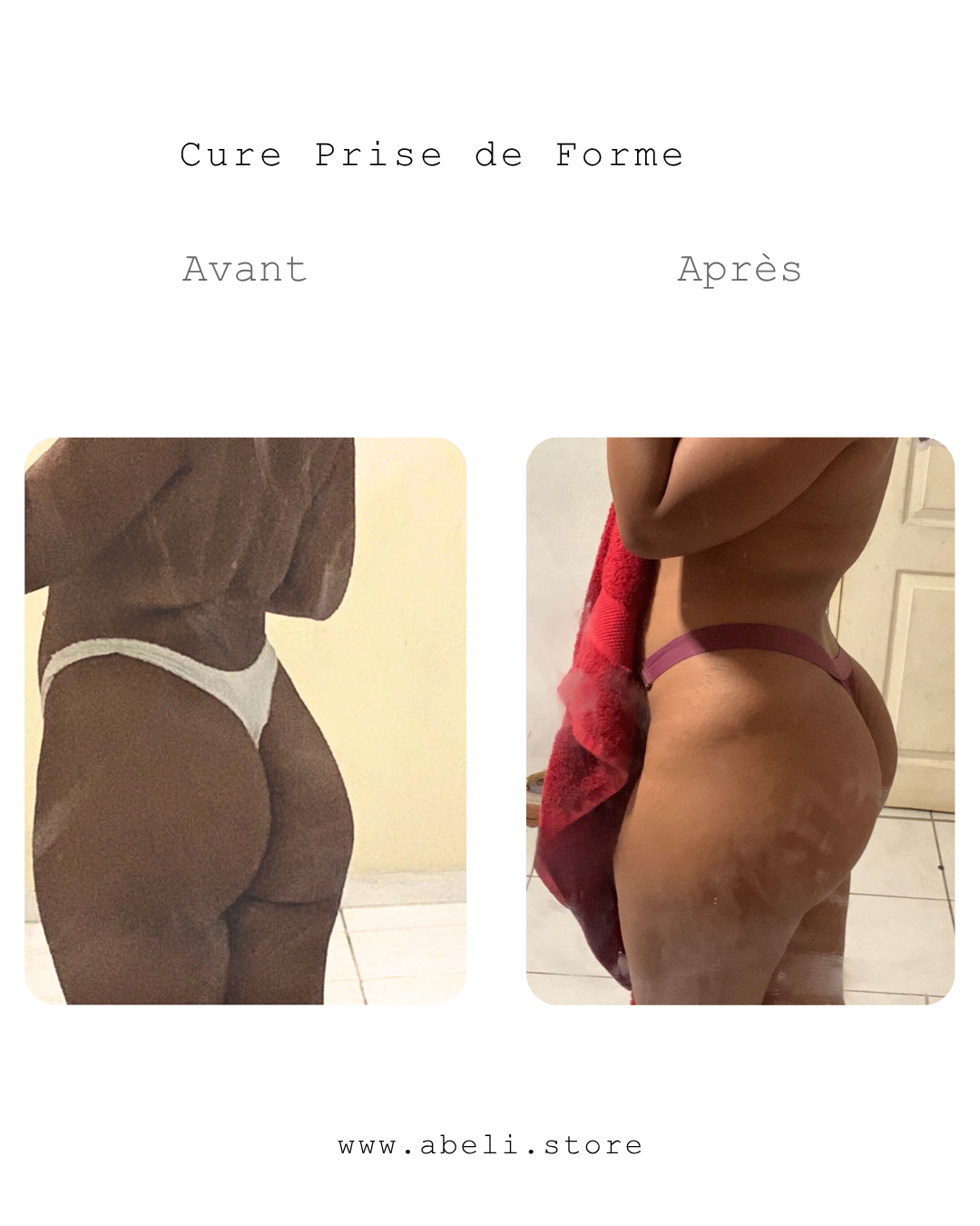 Pack prise de forme