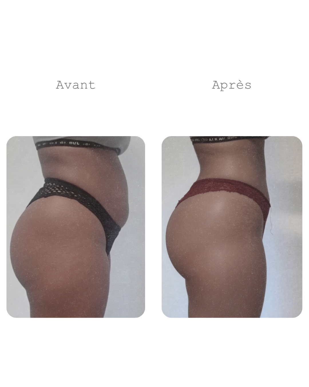 Cure minceur ventre plat