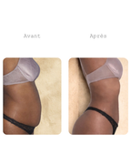 Cure minceur ventre plat