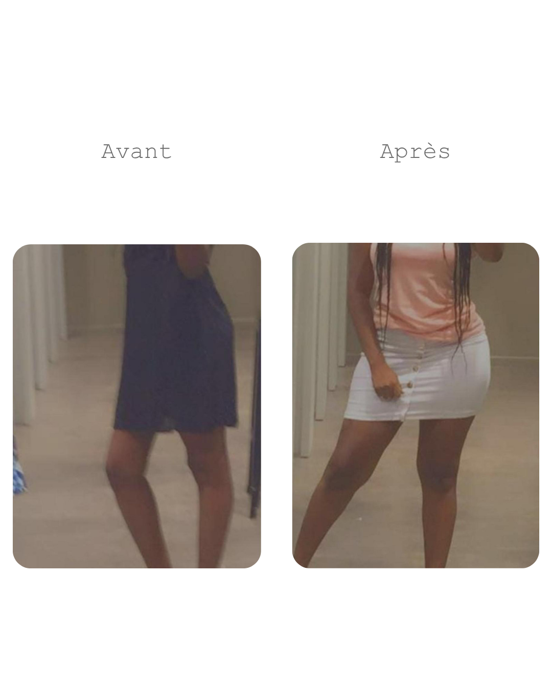 Box Prise de Forme