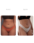 Cure minceur ventre plat