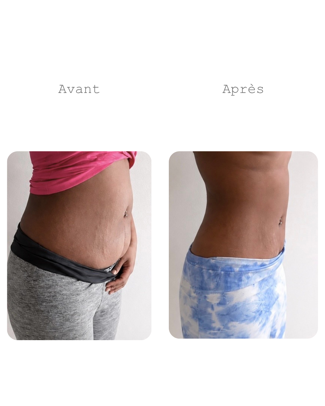 Cure minceur ventre plat