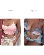 Cure prise de forme