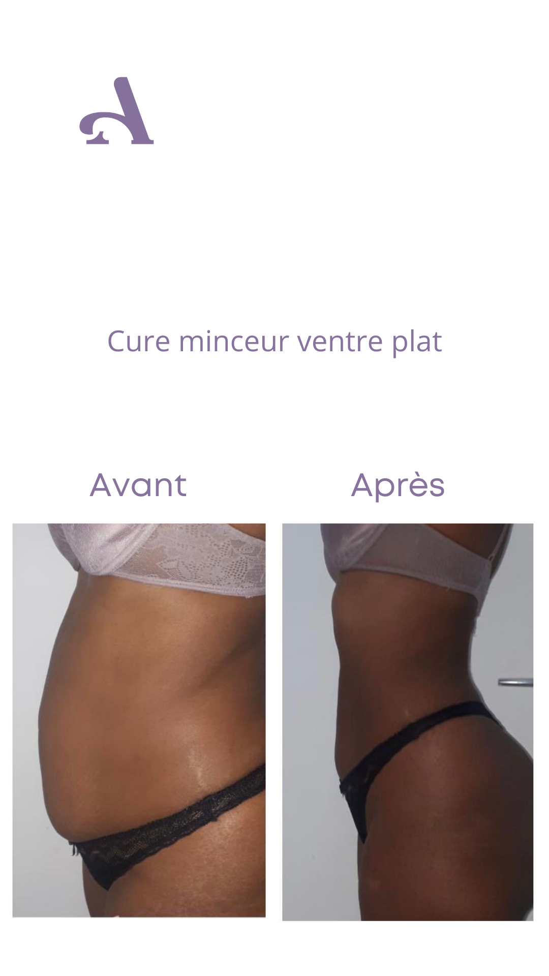 Cure Minceur / Ventre Plat