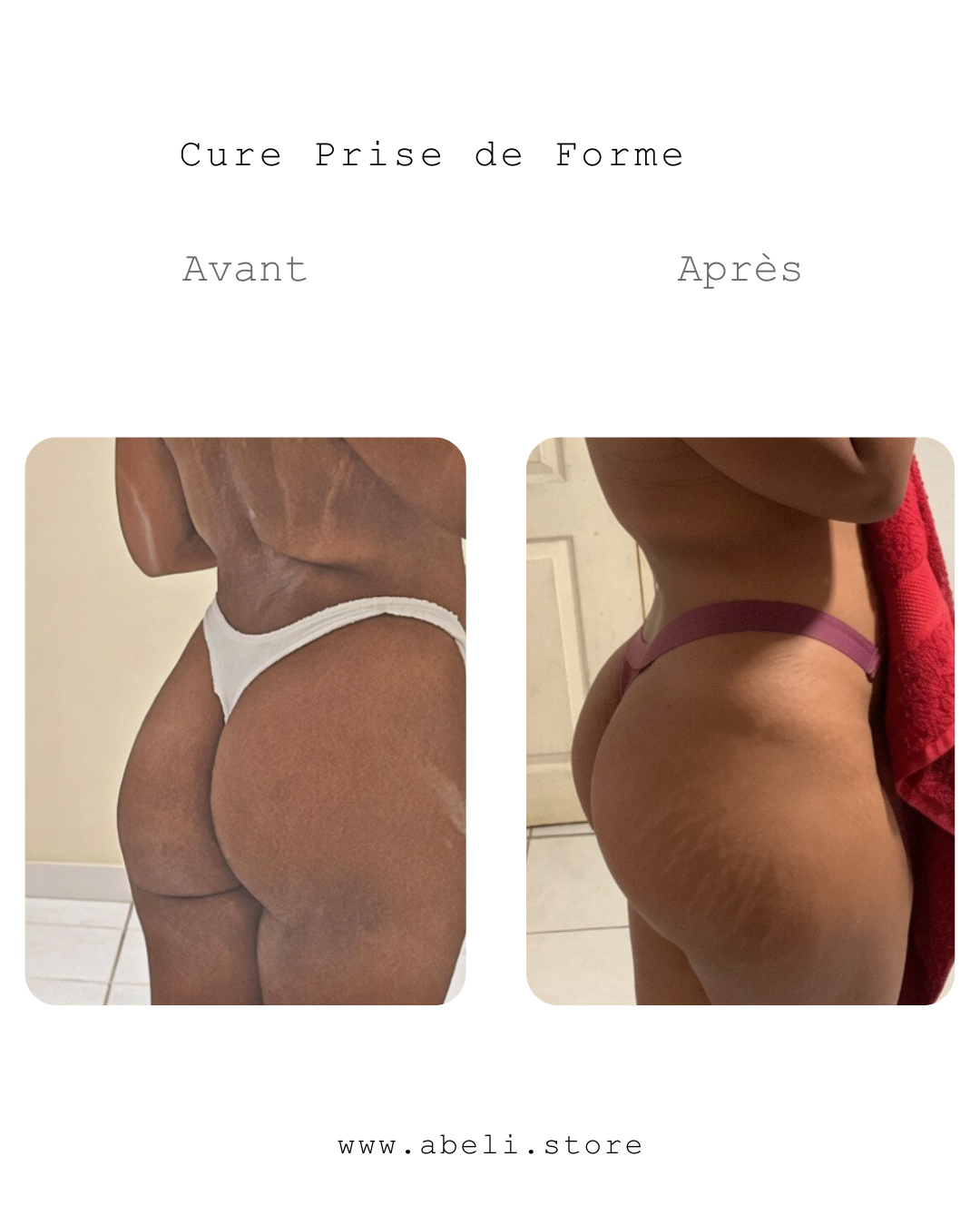 Pack prise de forme