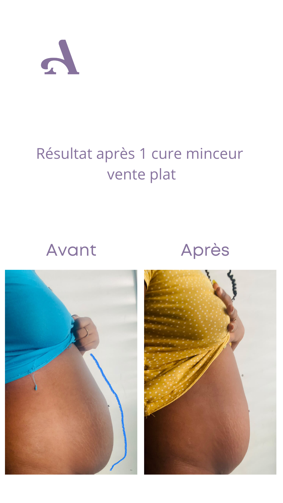 Cure Minceur / Ventre Plat