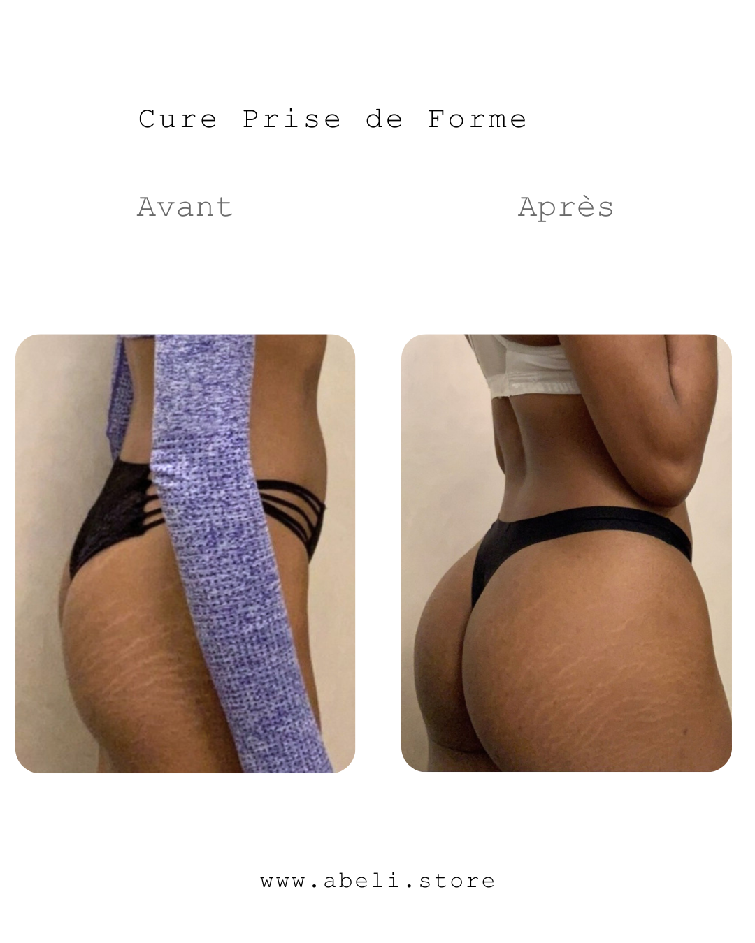 Pack prise de forme